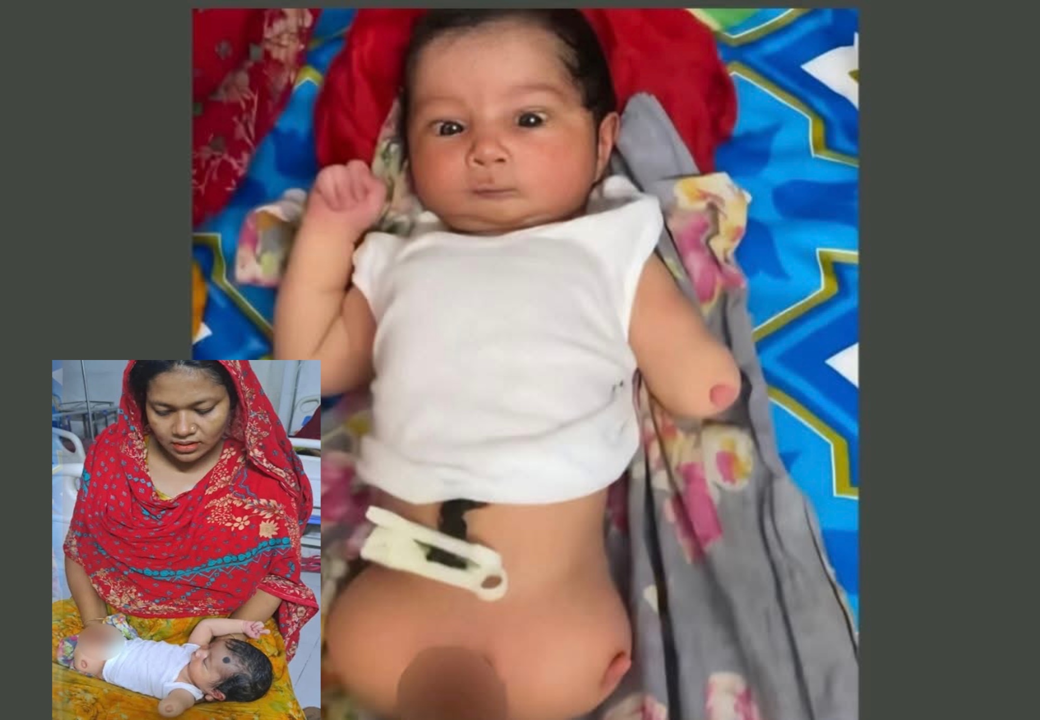 সন্তান প্রতিবন্ধী বলে ফেলে দিতে চান বাবা...